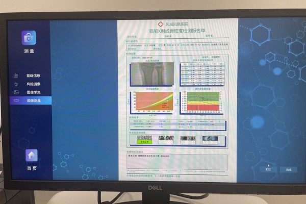骨密度低怎么辦？養(yǎng)成良好生活習(xí)慣，從多方面增強(qiáng)骨密度